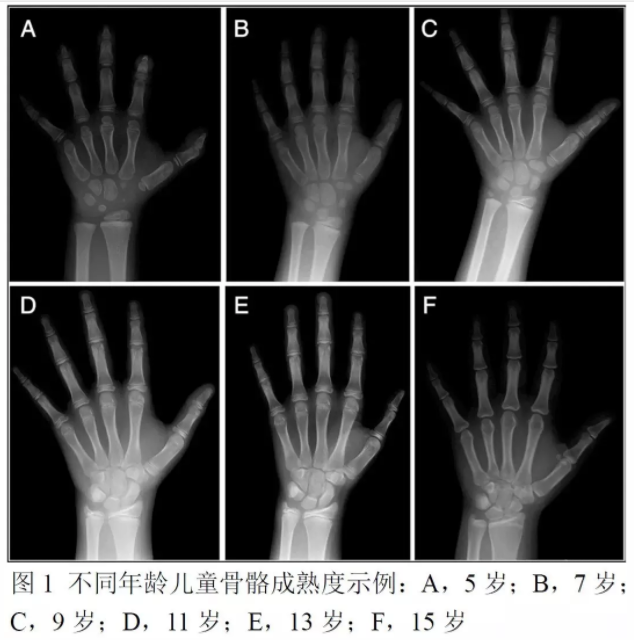 儿科专家提醒您：关于孩子身高的4个科学事实(图1)